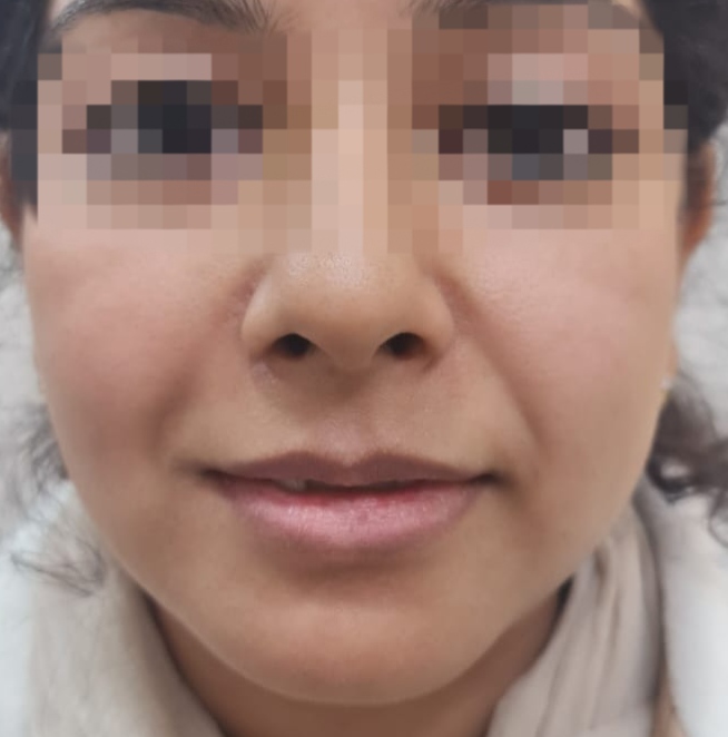 Before surgery