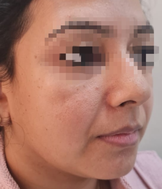 Before surgery