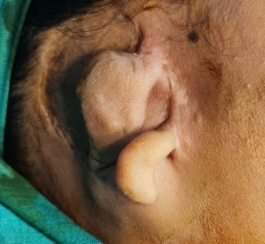 Before surgery