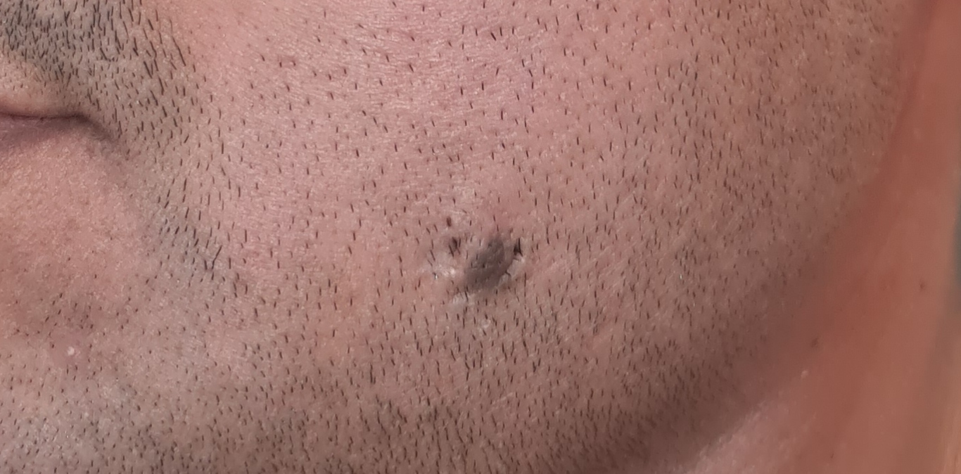 Before surgery