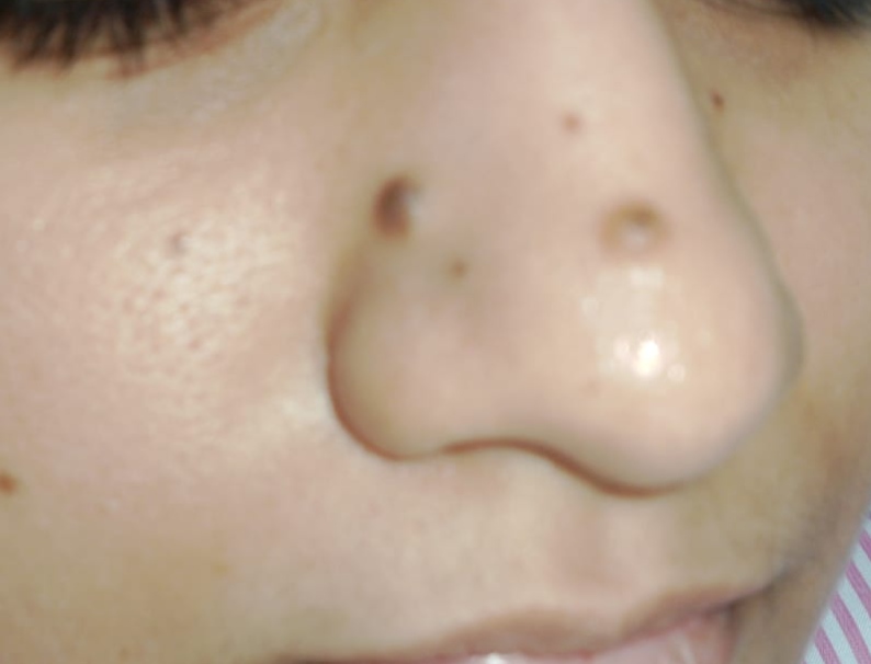 Before surgery