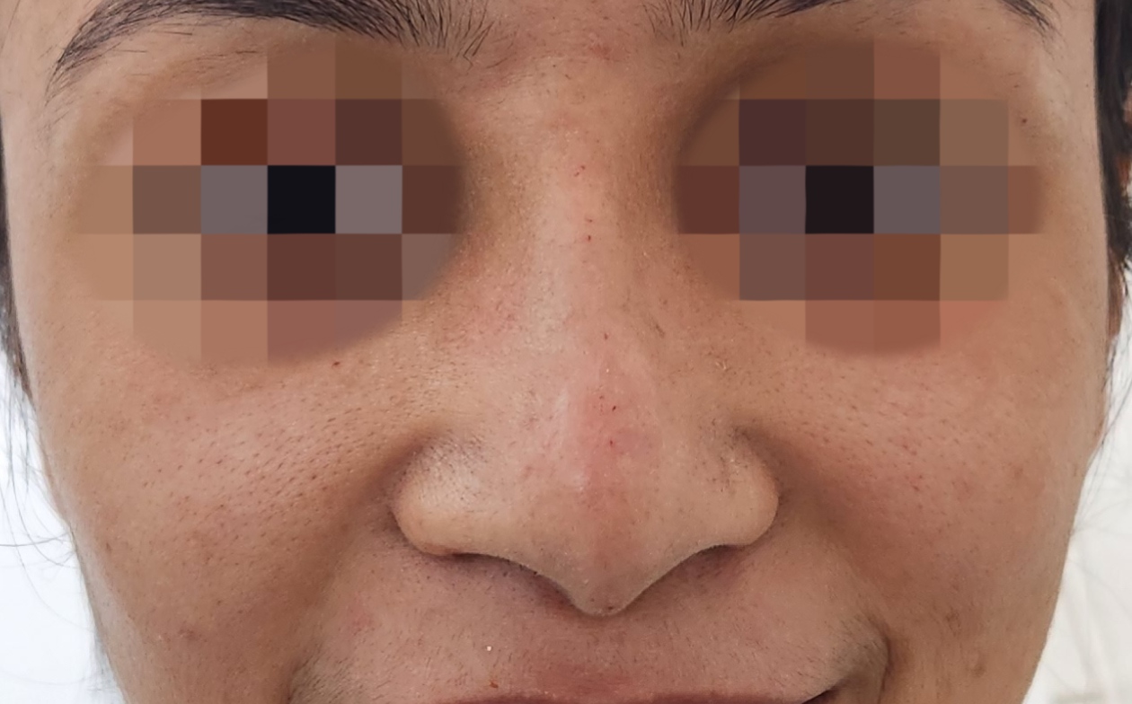 Before surgery