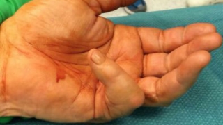 Before surgery