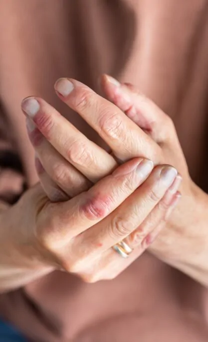 Hand Infections