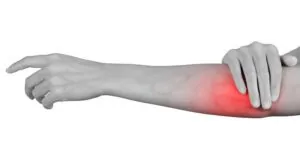 Tennis Elbow