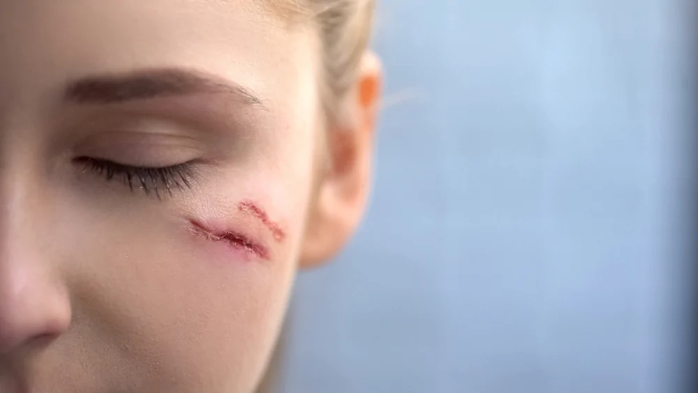 Scar Revision — hero image