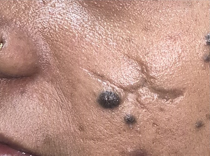 Before surgery